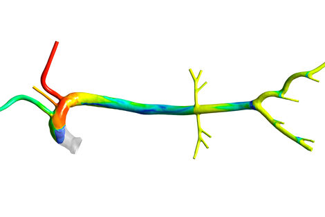 Verteilung des mit sauerstoffangereicherten Blutes im arteriellen Gefäßsystem